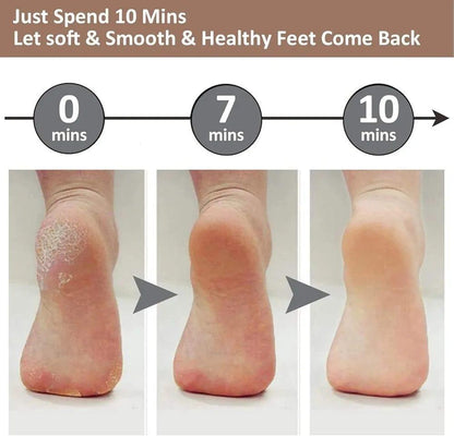 Flawless Electric Callus Remover for Feet