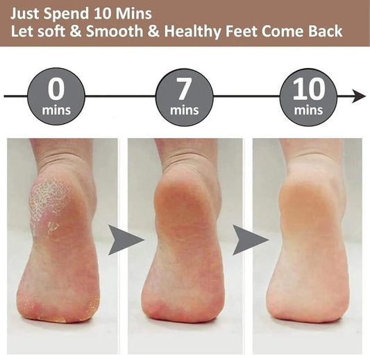 Flawless Electric Callus Remover for Feet